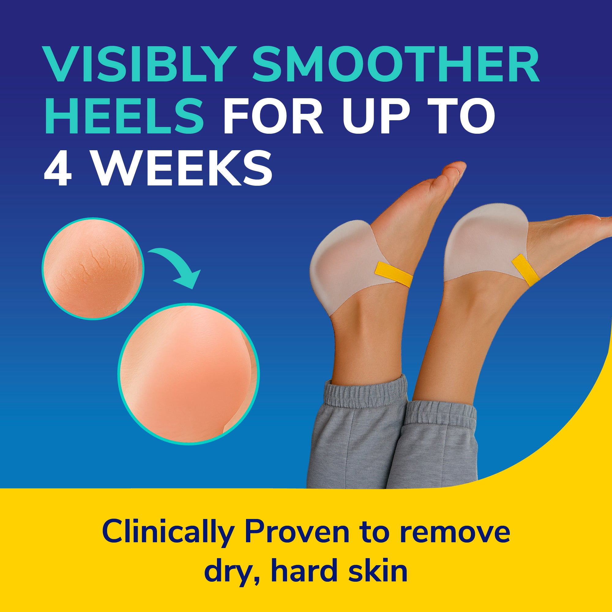 Dr. Scholl’s™ Exfoliating Heel Peel Mask