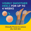 Dr. Scholl’s™ Exfoliating Heel Peel Mask
