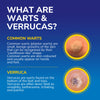 Dr. Scholl’s™ Freeze Away MAX Verruca and Wart Remover