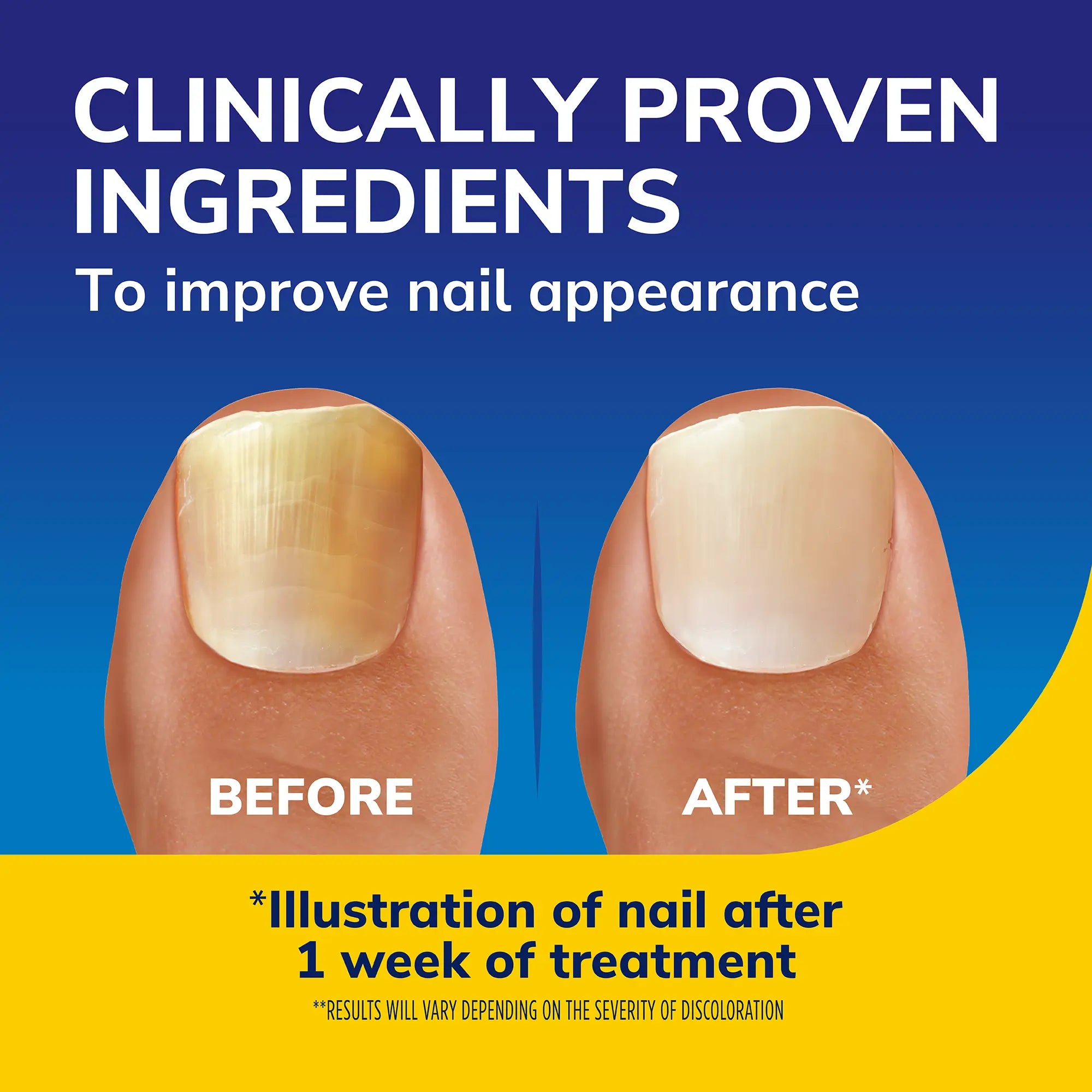 Dr. Scholl's™ Nail Revitaliser Serum 10ml