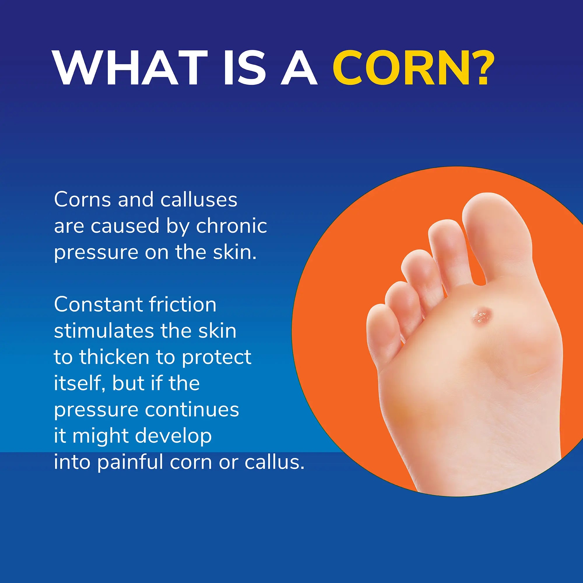 Dr. Scholl's™ All-In-One Corn Removal Pen
