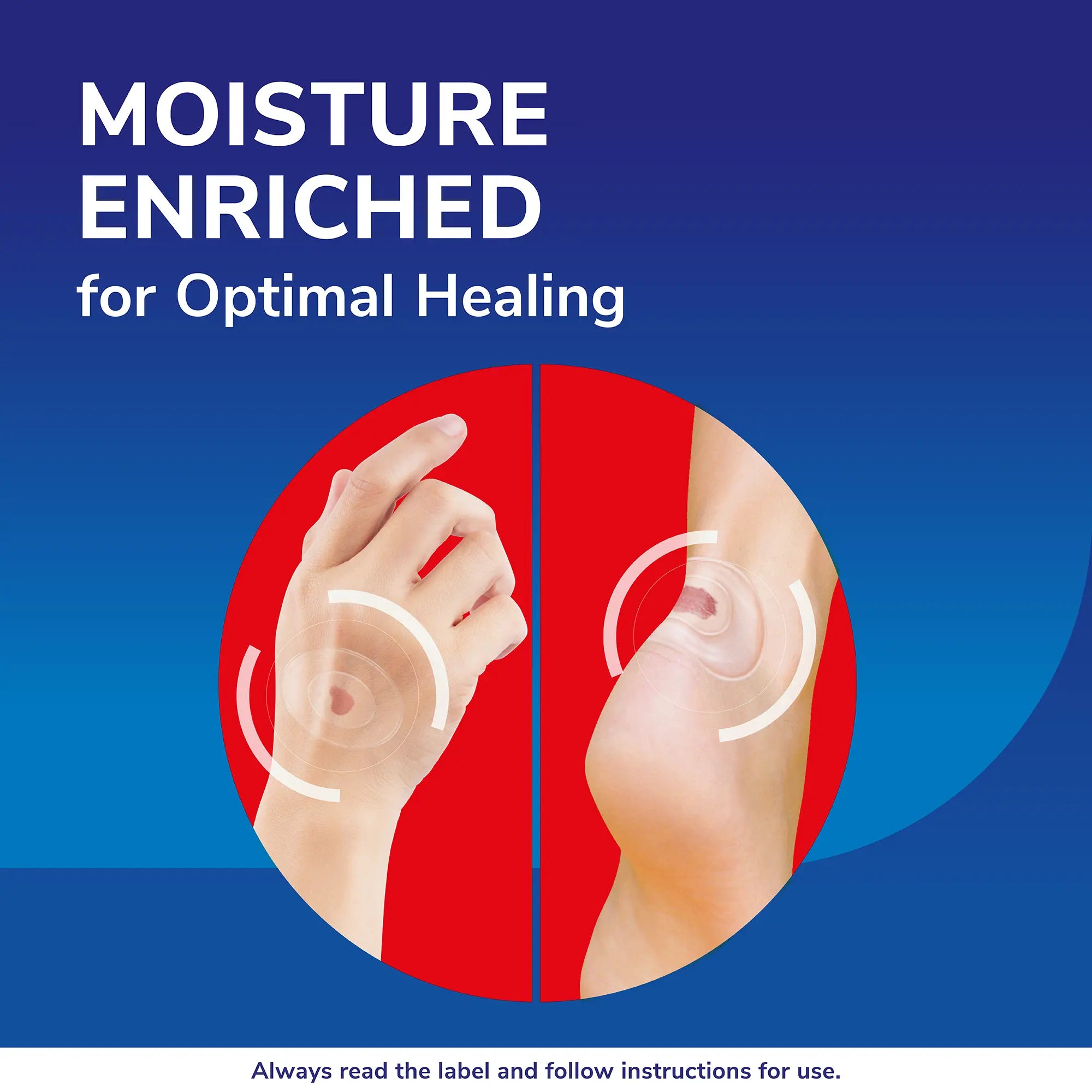 Dr. Scholl’s™ Open Blisters, Cuts and Grazes Medical Grade Blister Plasters